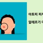 아토피 피부염 관리와 알레르기 대응